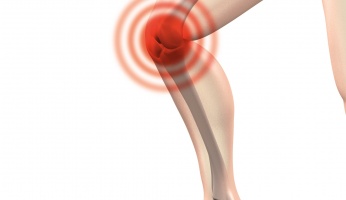 image of runners knee