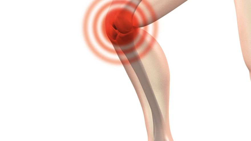 image of runners knee