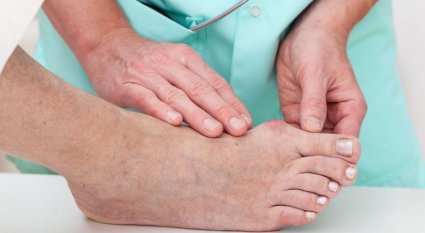 Home Remedies to Treat, Exercise, and Prevent Bunions