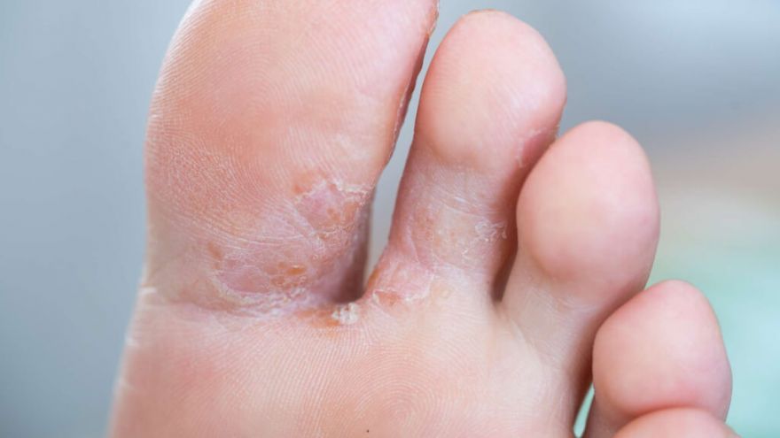 Why Do My Feet Itch at Night?